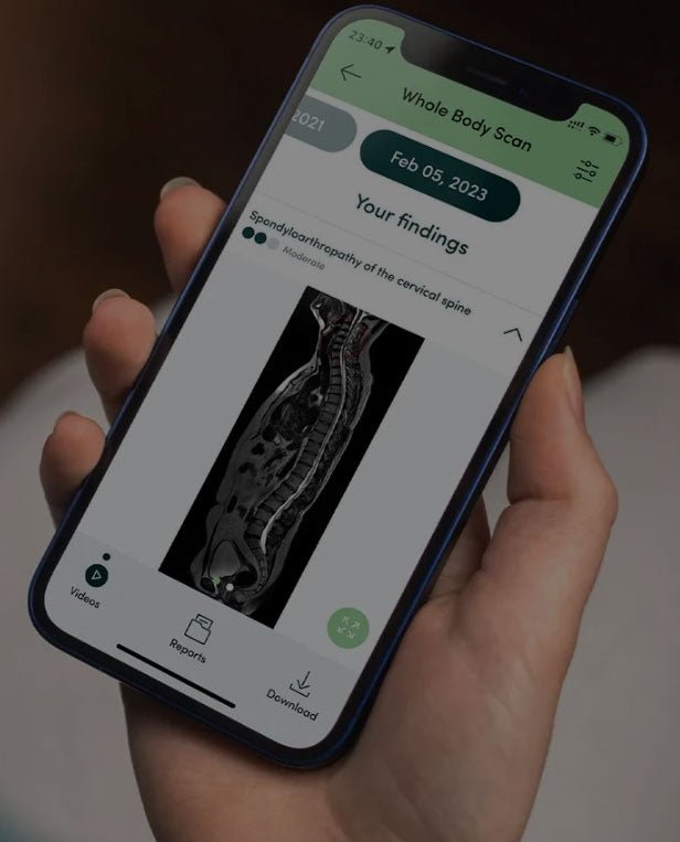 Prenuva Whole Body Scan - GreaterT